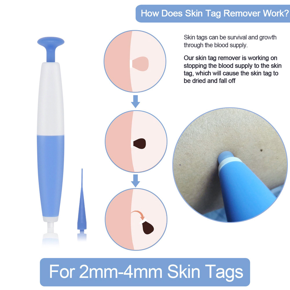 Skin Tag Removal Kit Home Use Mole Wart Remover Micro Band Skin Tag Treatment Tool Easy To Clean Skin Care Tool - Image 5